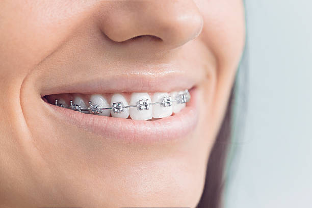 Best Traditional Braces  in Plainview, TN